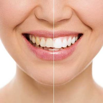 Davis Dental Group - Cosmetic Dentists Near Me - Amarillo, Texas Davis Dental Group - Cosmetic Dentists Near Me - Amarillo, Texas
