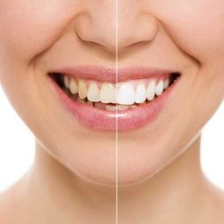 Derek Davis, DDS