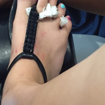 Kings Nail IV - This is what they gave me when I asked for a stripe !!! Worst salon on the island - Nail Salons Near Me - Staten Island, New York
