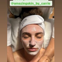 Amazing Skin By Carrie