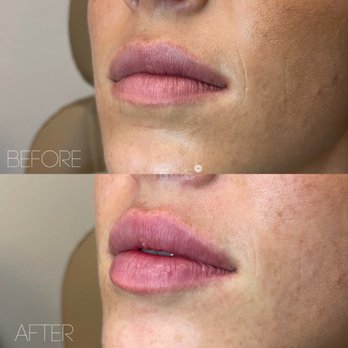 Femme Medspa - Medical Spas Near Me - Charlotte, North Carolina Femme Medspa - Medical Spas Near Me - Charlotte, North Carolina