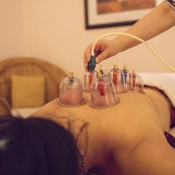 Swan Spa - Cupping - Beauty & Spas Near Me - Queens, New York Swan Spa - Cupping - Beauty & Spas Near Me - Queens, New York