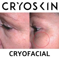 MaryAnn's Aromatherapy And Wellness - Cryskin Facial Uplift softening wrinkles
