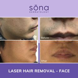 Sona Dermatology of Greensboro