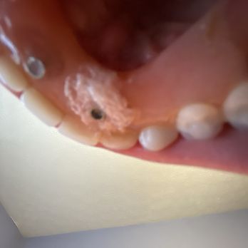 Livesay Kenneth W Dr - Oral Surgeons Near Me - Louisville, Kentucky Livesay Kenneth W Dr - Oral Surgeons Near Me - Louisville, Kentucky
