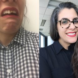 Supertooth Dentistry - Me with Kevin Hart on the left. The same me on the right but with beautiful Supertooth teeth! RIP, Kevin Hart.