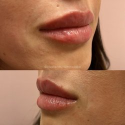 Blush and Bloom MedSpa