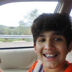 Just Smile Orthodontics - Day 1 braces and right after braces