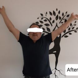 Natuever Acupuncture - Shoulder pain