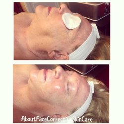 Corrective Skincare LV - Anti Aginf Facial