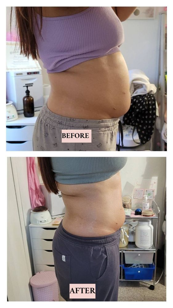 Allure Body Sculpting Logo