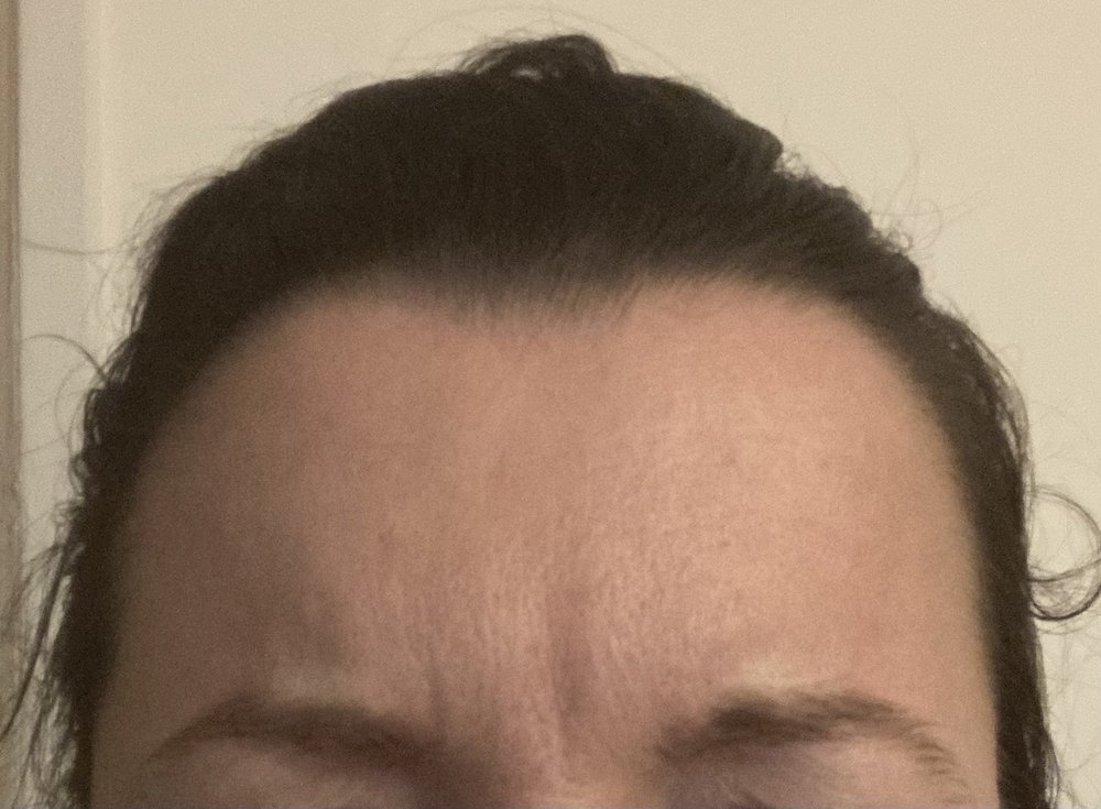 Face Forward Skin Care Center Logo