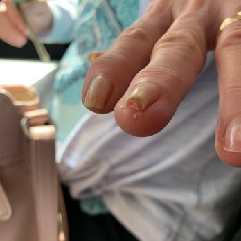 Raindrop Natural Nail Spa - AFTER WELL OVER A YEAR FIGHTING INFECTIONS - Nail Salons Near Me - Cheyenne, Wyoming