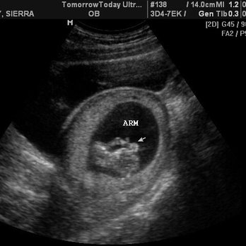 TomorrowToday Ultrasound - Ultrasound Imaging Centers Near Me - Aiea, Hawaii TomorrowToday Ultrasound - Ultrasound Imaging Centers Near Me - Aiea, Hawaii
