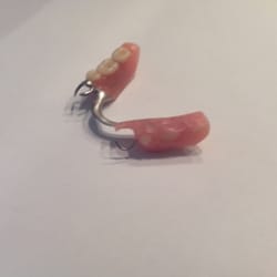 Fireberg Family Dental - A year later young Dentist just ground teeth off, would u let them make new one?
