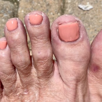 Q T Nails - Awful pedicure ...no maintenance of cuticles or dead skin nothing! - Nail Salons Near Me - Wilmington, North Carolina Q T Nails - Awful pedicure ...no maintenance of cuticles or dead skin nothing! - Nail Salons Near Me - Wilmington, North Carolina