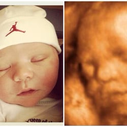 4D Ultrasound of Napa Valley - Side by side! One day old (10+ pound at birth) next to his 28 week 3D/4D Ultrasound.