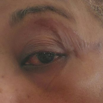 Beauti Mak - ... why was hot waxed applied to this area. - Hair Salons Near Me - Las Vegas, Nevada