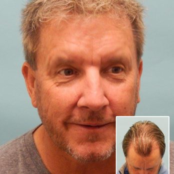 McGrath Medical - Hair Loss Centers Near Me - Austin, Texas McGrath Medical - Hair Loss Centers Near Me - Austin, Texas