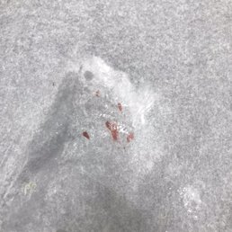 Blood from where I first started bleeding before she grabbed a towel and paper towels to try and stop the bleeding. Blood from where I first started bleeding before she grabbed a towel and paper towels to try and stop the bleeding.