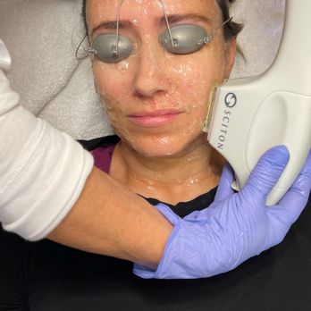 Wellspring Skincare - Medical Spas Near Me - Roswell, Georgia Wellspring Skincare - Medical Spas Near Me - Roswell, Georgia