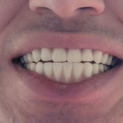 Aspen Dental - I believe that this Aspen Dental chain took advantage of me because I was a veteran that paid in cash.