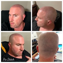 Scalp Micro USA