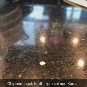 Sugoi Sushi - Many chipped part of my teeth at Sugoi sushi. - Japanese Near Me - Corvallis, Oregon