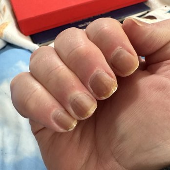 Esta Nail Spa - Clear polish that turned a gross brown color. - Nail Salons Near Me - Menifee, California Esta Nail Spa - Clear polish that turned a gross brown color. - Nail Salons Near Me - Menifee, California