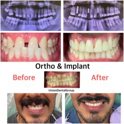 Union Dental Group - Ortho & Implant