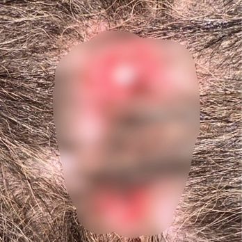A Pooch's Paradise - THIS IS JUST ONE OF THIS WOUNDS!!!!!!!!!!! I HAD TO BLUR IT A BIT BECAUSE APPARENTLY IT LOOKED TOO GRAPHIC ACCORDING TO YELP!!!!!!! - Pet Sitting Near Me - San Martin, California