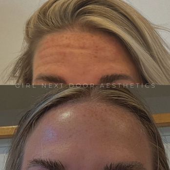 Girl Next Door Aesthetics - Medical Spas Near Me - Arnprior, Ontario Girl Next Door Aesthetics - Medical Spas Near Me - Arnprior, Ontario