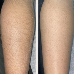 Bare Necessities Wax Studio - Before and After ... Lower Leg
