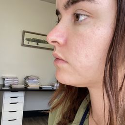 before treatment before treatment