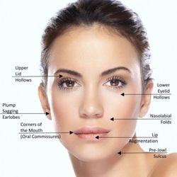 Moxie Salon & Spa - Diminish wrinkles with soft surgery that is quick healing from a surface only skin tightening technique.