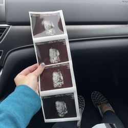 31 week ultrasound