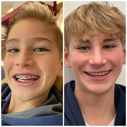 Dougherty Orthodontics - Before and after
