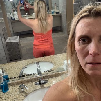 Smith Plastic Surgery - Before photo - shows how "square" I was before surgery. - Cosmetic Surgeons Near Me - Las Vegas, Nevada