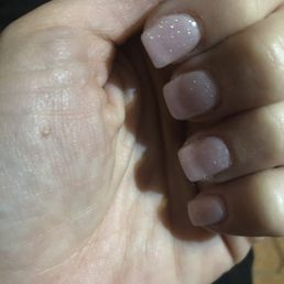 Nail tips detached from my natural nail. Nail tips detached from my natural nail.