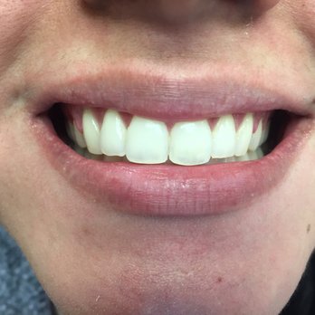 CaliSmile Orthodontics - Orthodontists Near Me - West Hills, California