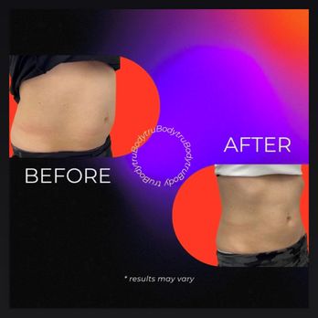 Gobare Aesthetic Studio - TruBody Treatment - Makeup Artists Near Me - Worcester, Massachusetts Gobare Aesthetic Studio - TruBody Treatment - Makeup Artists Near Me - Worcester, Massachusetts