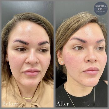 Skin Detour - Skin Care Near Me - Beverly Hills, California Skin Detour - Skin Care Near Me - Beverly Hills, California