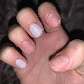 Lotus Nails - Nails peeling - Nail Salons Near Me - Rochester, New York