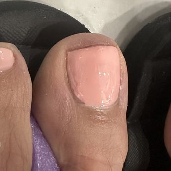 Luxury Nails & Spa - This pic was right after my pedicure. The guys got upset and didn't agreed with me about how bad my toe nail looked. - Nail Salons Near Me - Naples, Florida Luxury Nails & Spa - This pic was right after my pedicure. The guys got upset and didn't agreed with me about how bad my toe nail looked. - Nail Salons Near Me - Naples, Florida