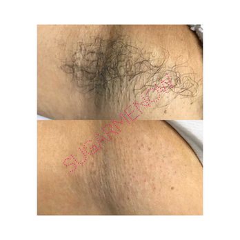 Sugar Me Now - Follow us on instagram for more pictures @sugarmenoww - Sugaring Near Me - Quincy, Massachusetts