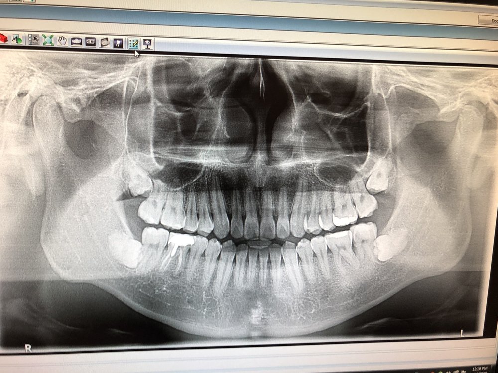 DENTAL IMPLANT AND ORAL SURGERY CENTER Updated June 2024 12 Photos