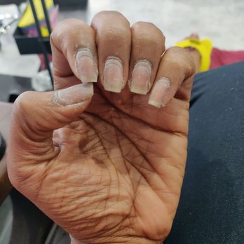 Millenia Nails & Day Spa - Zoom in and see the ridge that will take months to grow out! Never again. - Day Spas Near Me - Orlando, Florida
