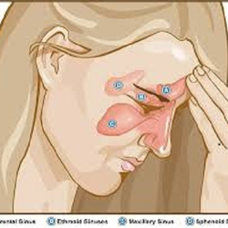 Adult & Pediatric Allergy Associates - Allergy and sinus problems - we can help!