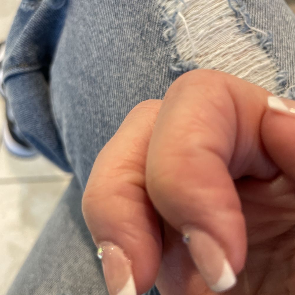 Polish peeling nails lifting Polish peeling nails lifting