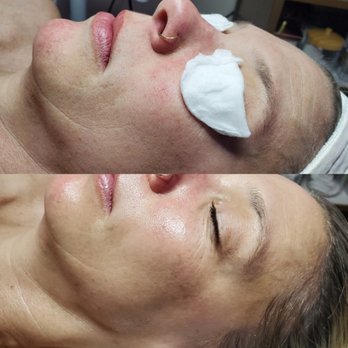 Glow-To Studio - Skin Care Near Me - San Diego, California